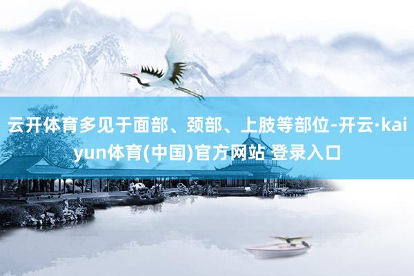 云开体育多见于面部、颈部、上肢等部位-开云·kaiyun体育(中国)官方网站 登录入口